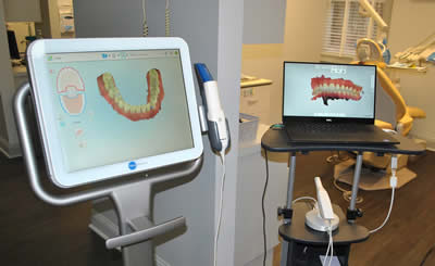 Digital images of dental implants displayed on computer screens, Marietta GA