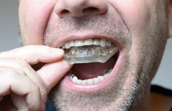 A man inserting a dental mouth guard in his mouth.