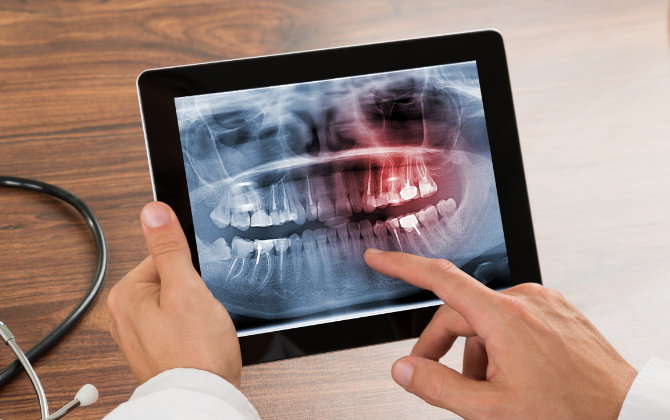 Marietta, GA dentist reviewing digital dental x-rays