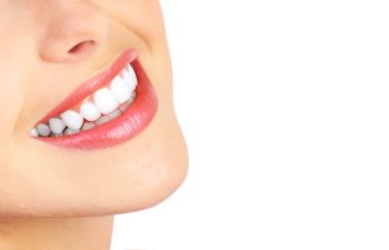 A woman smiles with her teeth whitened.