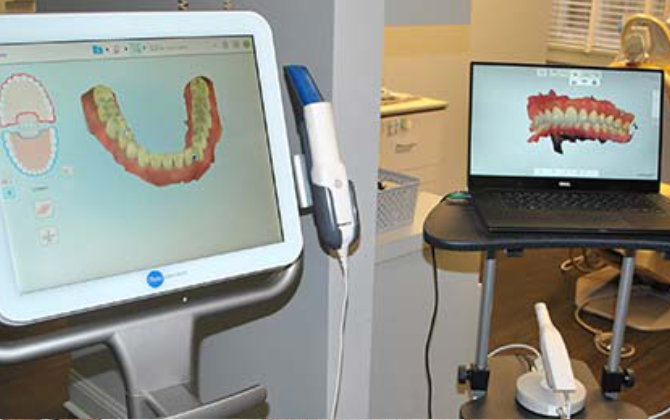 A dentist's office with iTero system