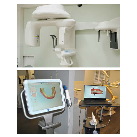 CBCT Scan Technology