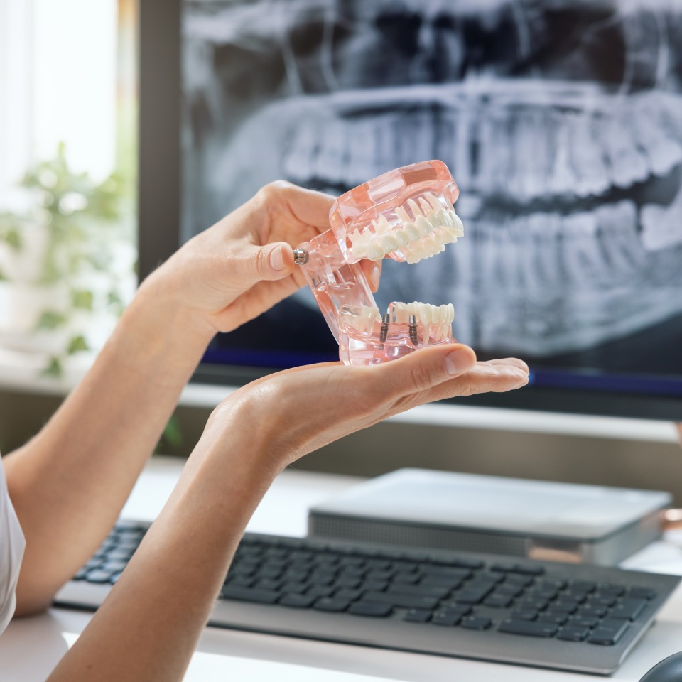 Dentist implantologist showing teeth model with implant screw sample in clinics office