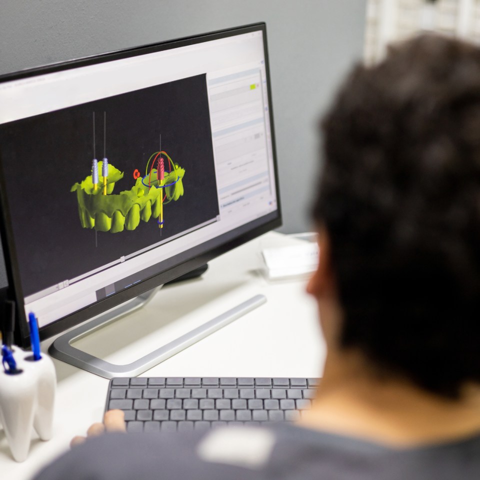 Dentist shows an implant surgery plan on his office monitor through a 3D X-ray.