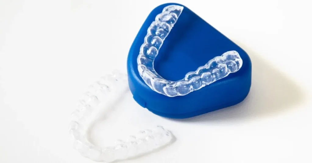 Simplyclear Aligners Marietta clear trays in blue case display