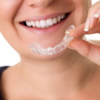 Simplyclear Aligners