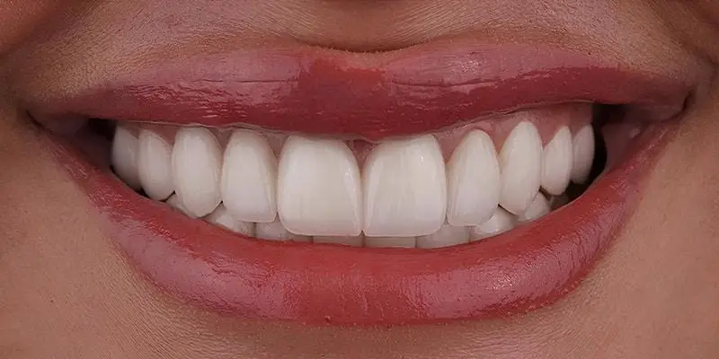 dental-image-after dental-image-after