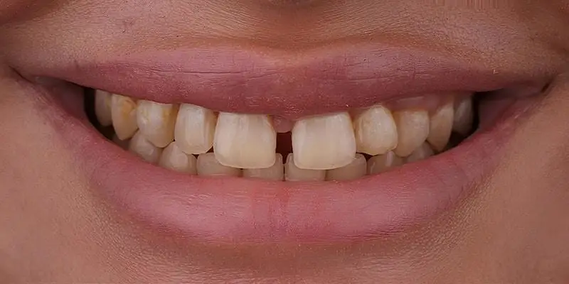 dental-image-before