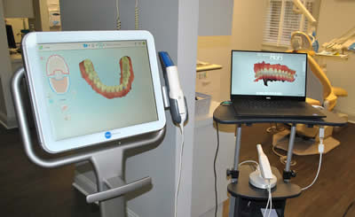 Dental Implants